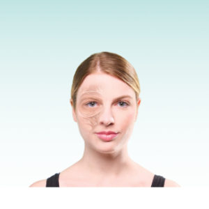 B4-DE Botulinumtoxin Onlinekurs